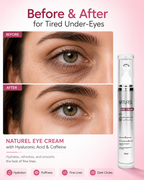 Eye Cream